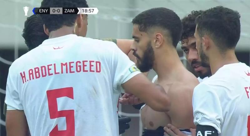 الزمالك يعلن إصابة بنتايج فى مفصل الكتف ويغيب شهرًا